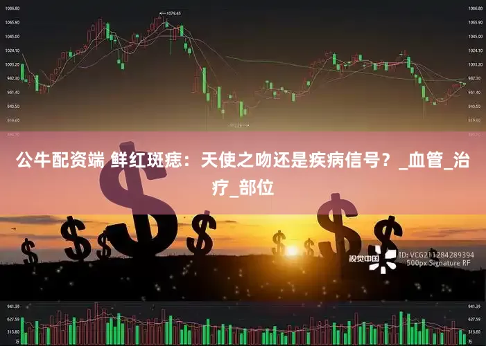 公牛配资端 鲜红斑痣：天使之吻还是疾病信号？_血管_治疗_部位